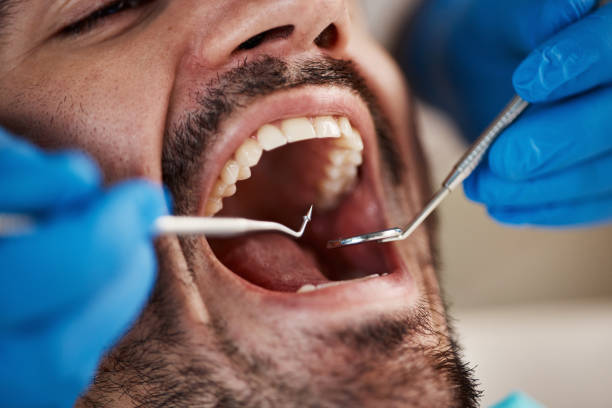 Best Tooth Extraction  in Abingdon, IL